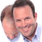 A small percentage of men (about 2 percent) who use Propecia for hair loss report problems with erectile dysfunction.