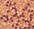 Research shows diseases may be diagnosed through antibodies.