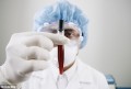 Baby Boomers Hepatitis C - Usually Hepatitis C can be diagnosed through a vial of blood administered through a blood test.