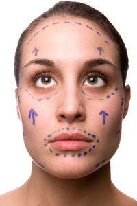 Facelift procedures increased 9 percent in 2010, along with every other popular cosmetic/plastic surgery procedure.