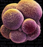 Stem Cell, Obesity, Xenical, Weight loss, Skinny, Health