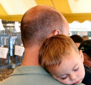 Male pattern hair loss is extremely common, even in younger men.