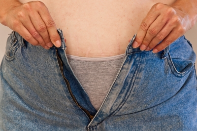Excess weight and obesity are considered an epidemic in the United States.