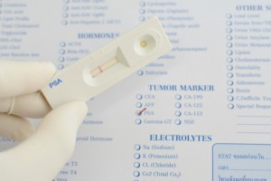 Although prostate cancer and benign prostatic hyperplasia target different parts of the prostate, both can cause enlargement. Your doctor may order a PSA blood test and other diagnostic exams to determine the source of your problem. 