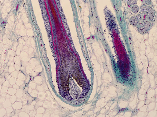 hair follicle hair follicle