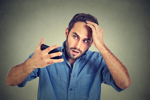 looking at receding hairline looking at receding hairline