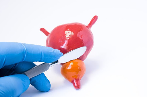 prostate model prostate model