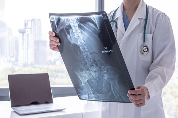 Doctor holding an X-ray Doctor holding an X-ray