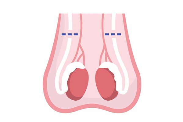 Testicles graphic Testicles graphic