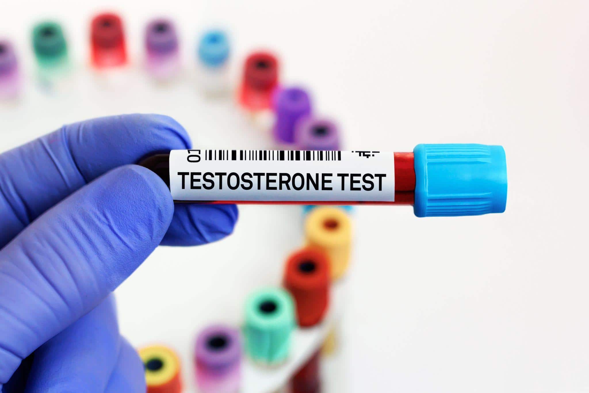 testosterone