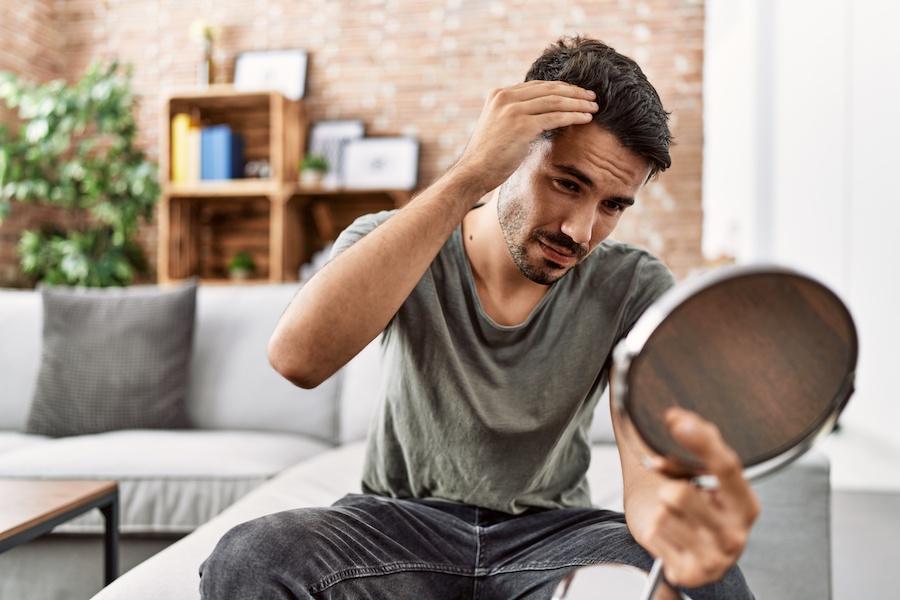 young man noticing hair loss signs in his temples