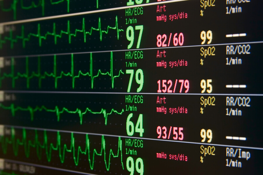 Will Viagra Raise my Heart Rate
