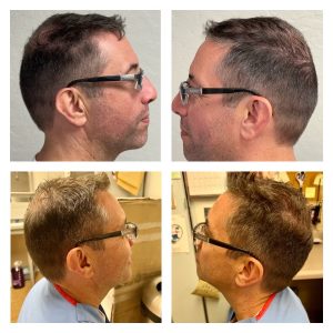 results from eDrugstore clients using our hair growth supplements