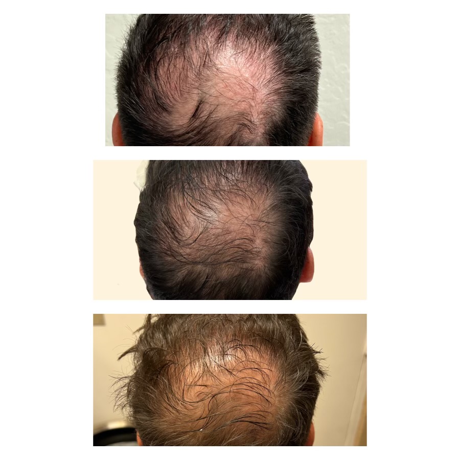 results from eDrugstore clients with our hair growth solutions results-from-edrugstore-clients-with our-hair-growth-solutions