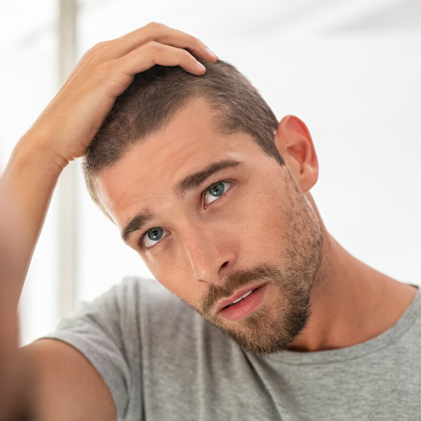 Hair Growth for Men